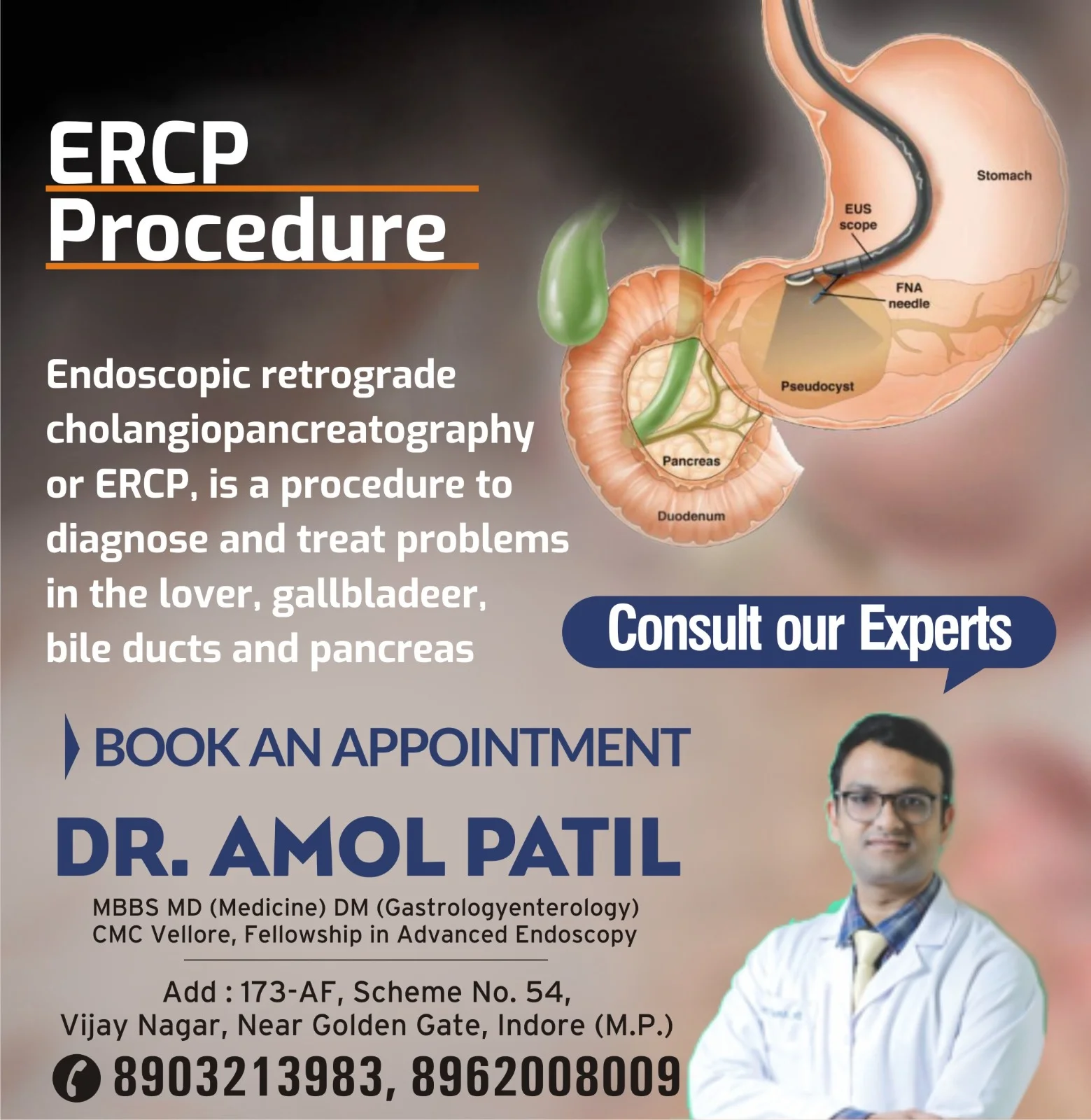 ERCP Treatment