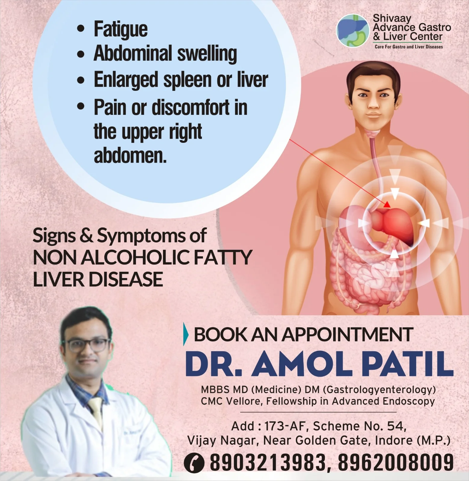 Fatty Liver Treatment