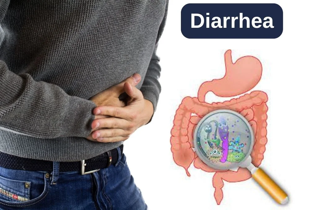 Diarrhea Treatment In Indore