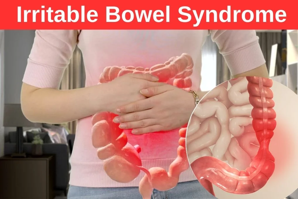 Irritable bowel syndrome Treatment in Indore