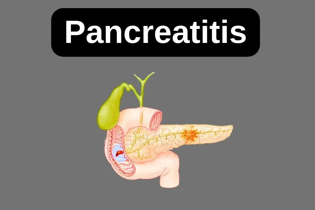 Pancrease Disease Treatment In Indore