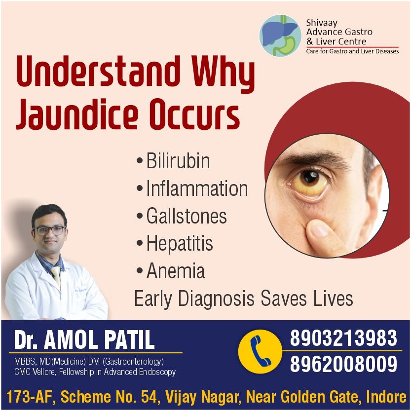 Best Doctor for Jaundice Treatment In Indore