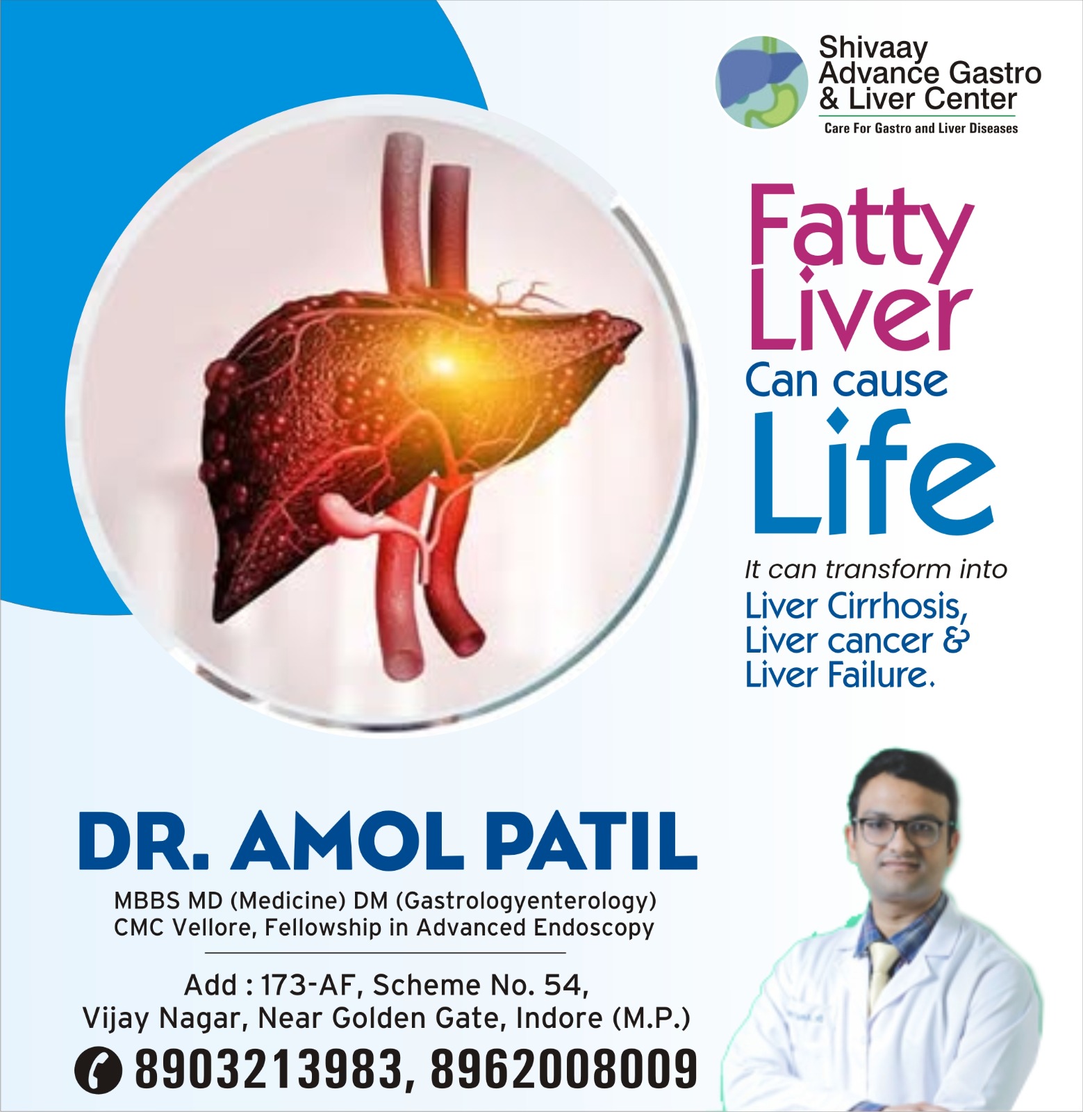 Best Fatty Liver Specialist in Indore