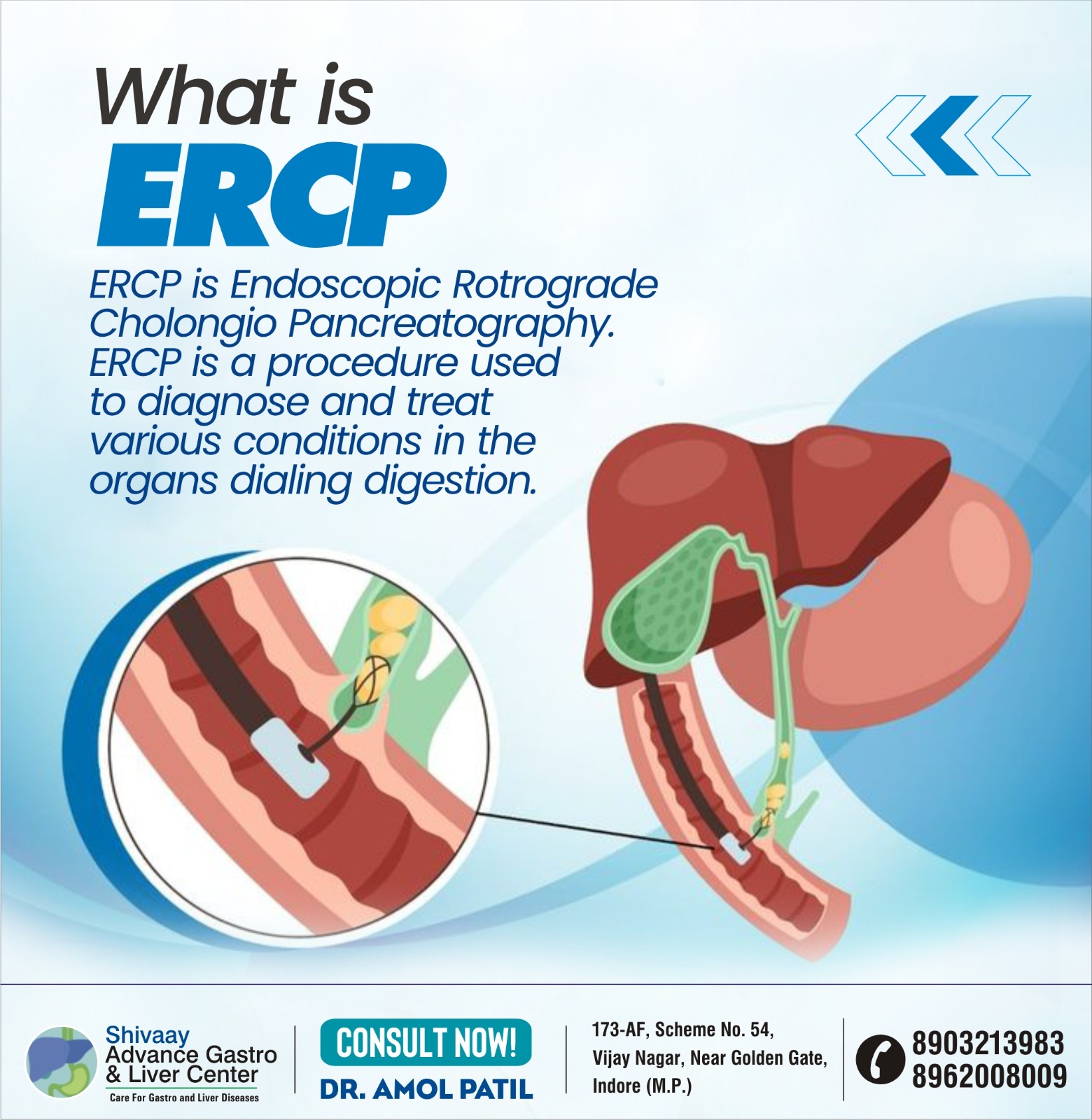 Best ERCP Specialist in Indore
