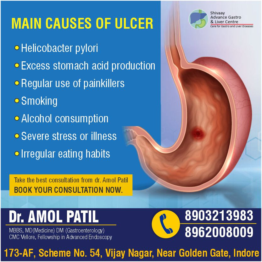 Best Doctor for Ulcer Treatment in Indore 