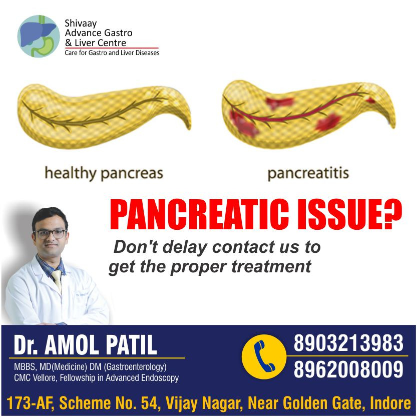 Best Pancreatic Issue Specialist in Indore 