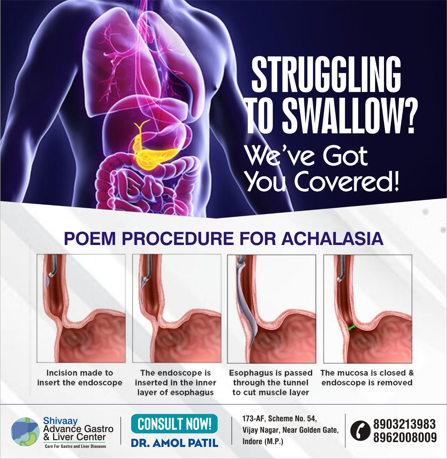 POEM Specialist in Indore 