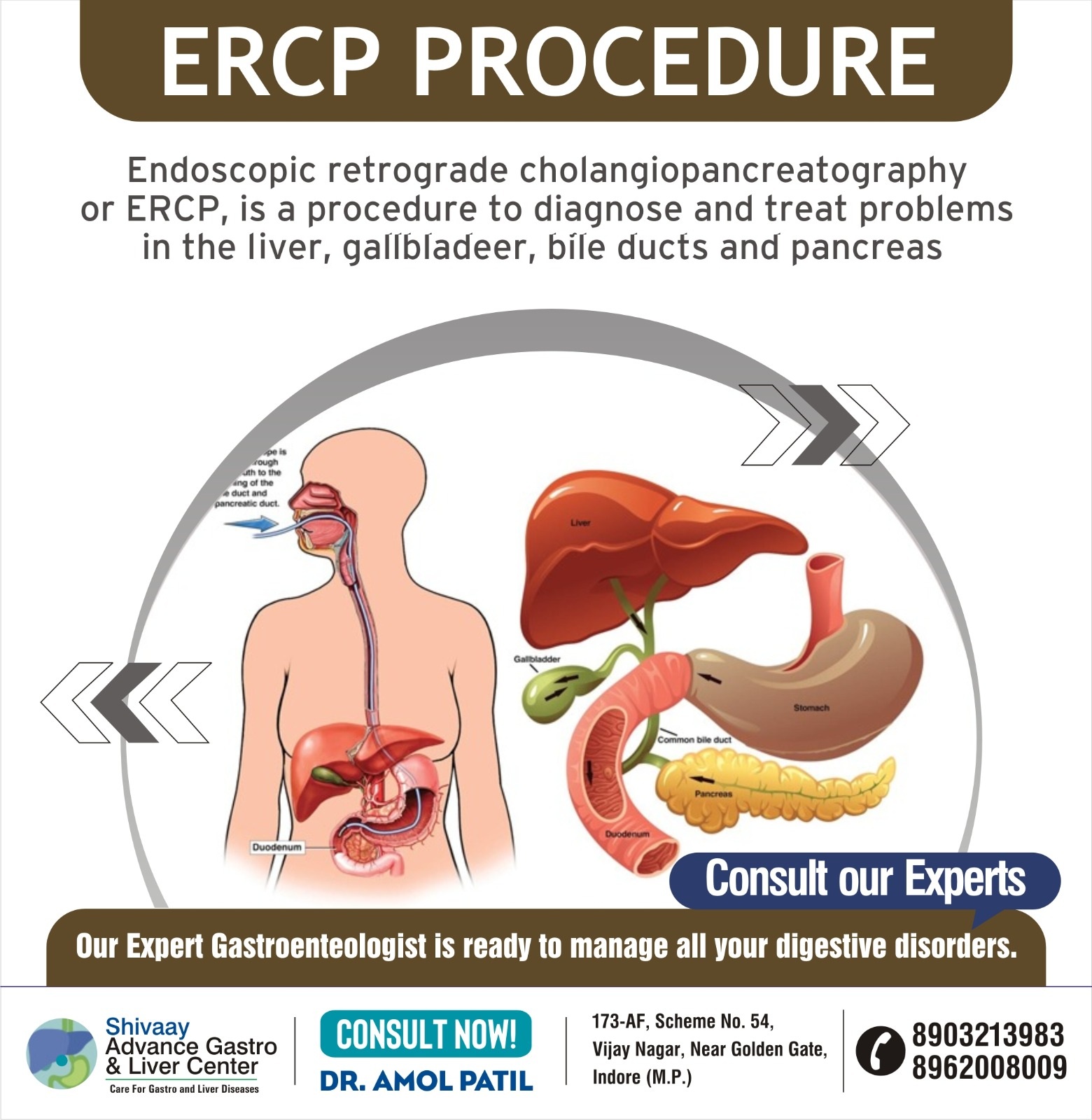 Best ERCP Treatment Center In Indore